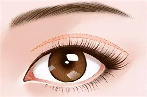 二、哪些因素在影响隆鼻的修复速度?