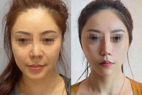 益都中 心医院烧伤整形科怎么样？