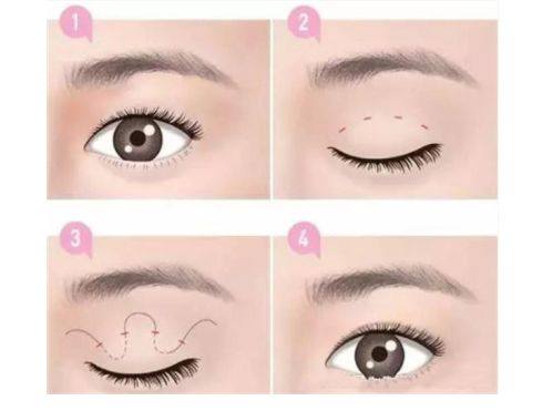 杭州米洋医疗美容诊所擅长项目：