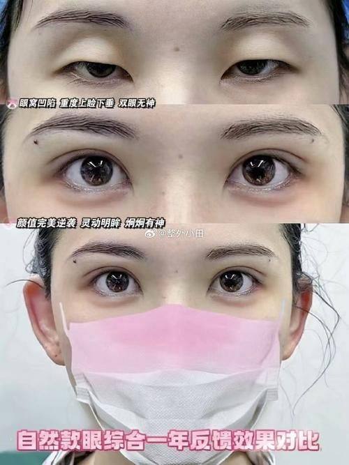 合肥亚典整形美容医院口碑评价