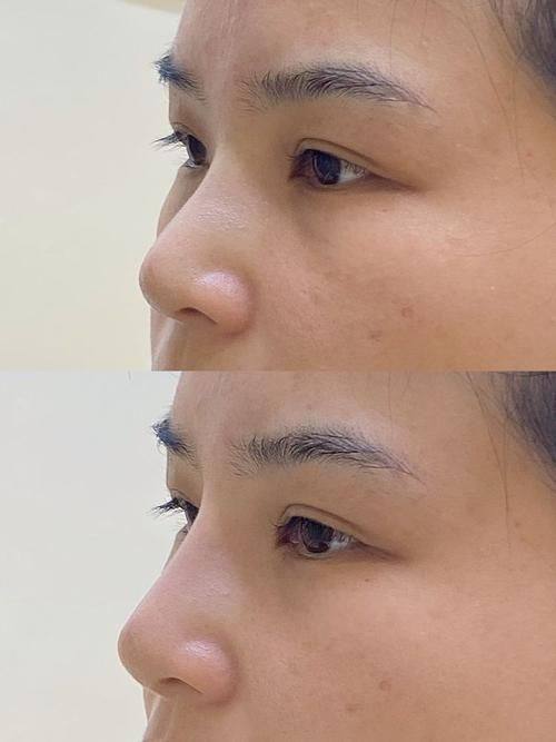 合肥亚典整形美容医院擅长项目