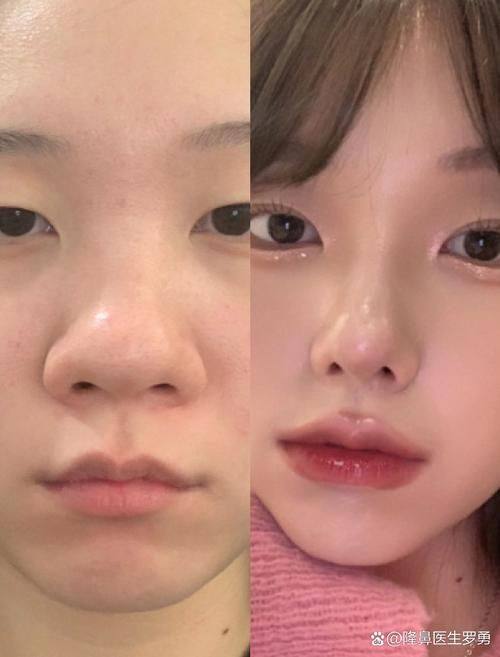 河北李美熊医疗美容门诊部怎么样？