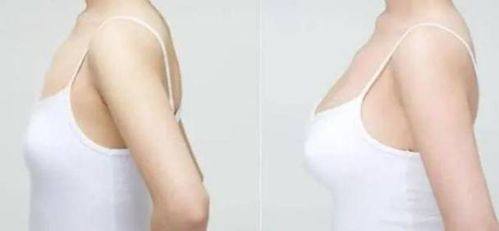 莆田少珍整形美容医院怎么样？