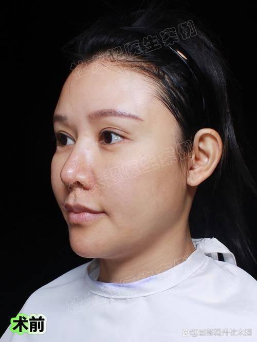 成都大眼睛整形医疗美容门诊部地址电话及营业时间：