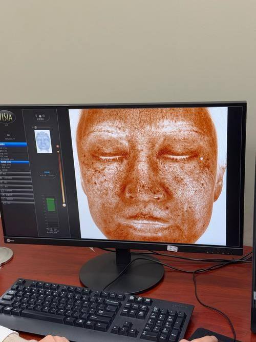 渭南现代整形医疗美容医院擅长项目：