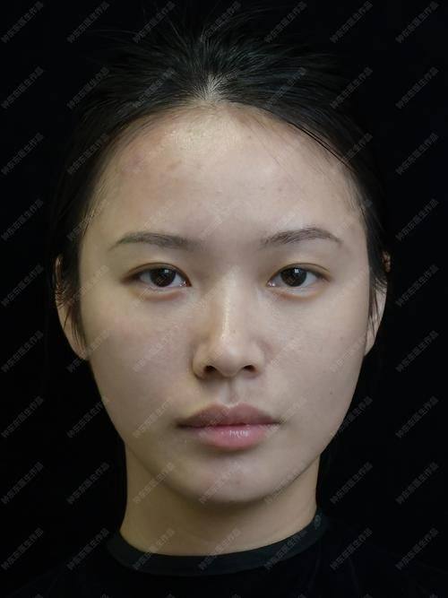 合肥亚典整形美容医院地址电话及营业时间