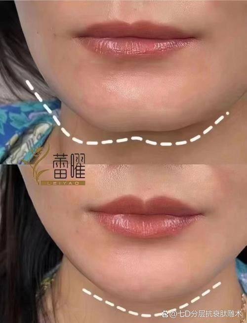 益都中 心医院烧伤整形科预约挂号方式