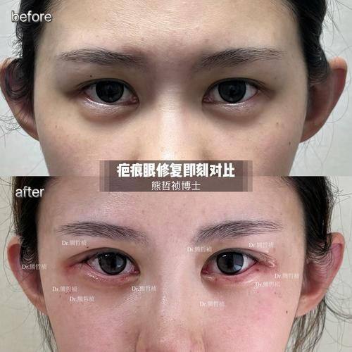 北京联合丽格第一医疗美容医院擅长项目：