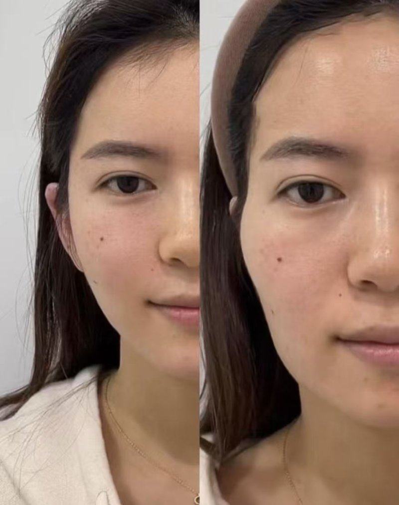 二、药物干预：从外用到注射，多维度缓解疼痛与增生