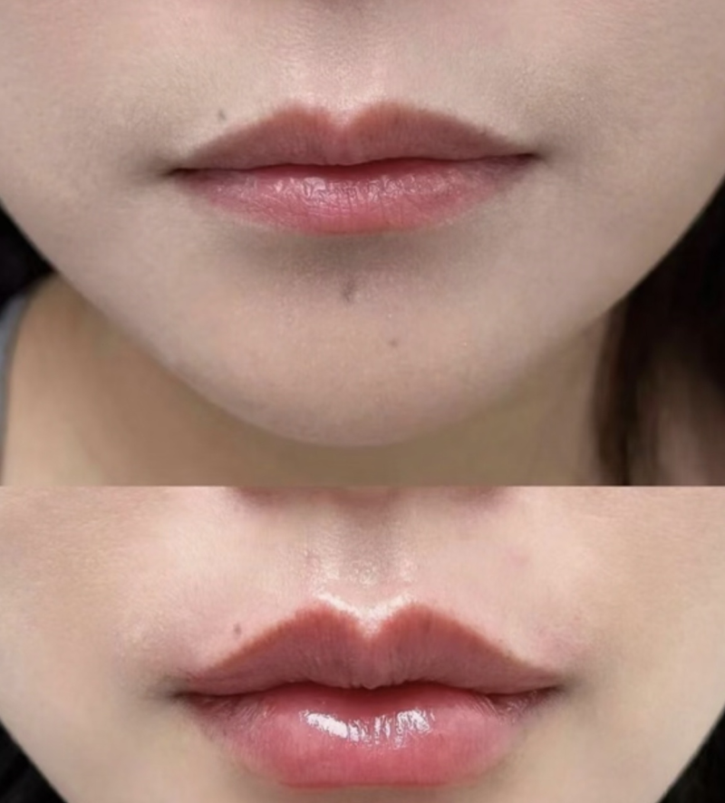 八、混合型因素