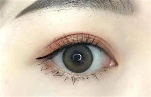 内蒙古呼和浩特紫洁一科整形医院怎么样？