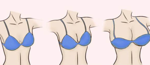 二、特殊脸部疤痕：取奥美定后增生的处理