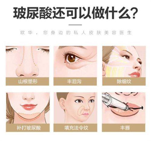 三、医美手段：单眼皮与双眼皮的主动切换方案