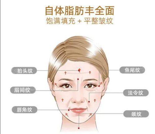 四、决定割双眼皮价格高低的核心因素