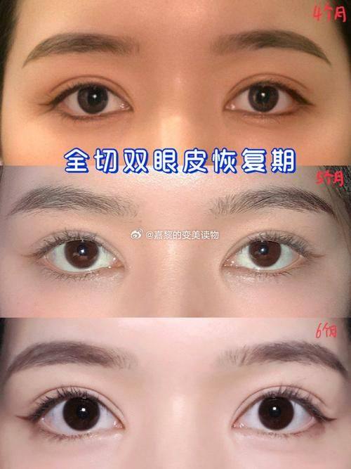 内蒙古呼和浩特紫洁一科整形医院价格表：