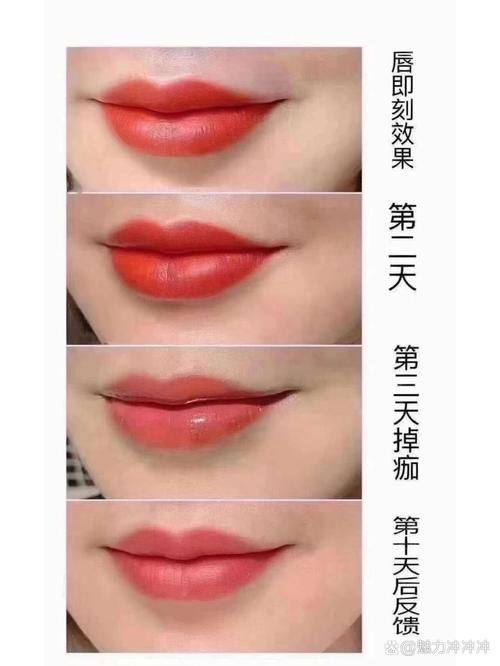 石家庄新兴中医皮肤病医院中医美容科价格表：