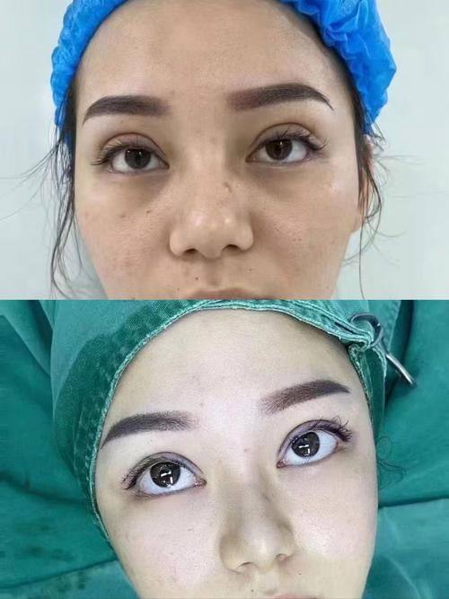 内蒙古呼和浩特紫洁一科整形医院擅长项目：