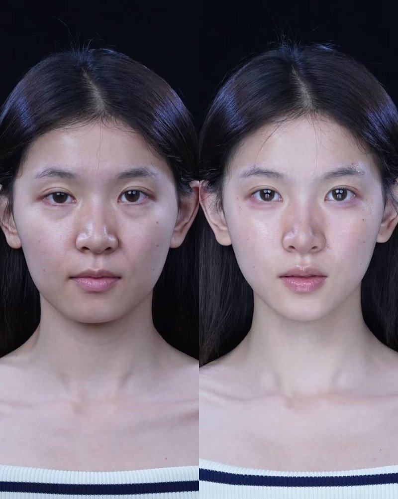 五、不同部位术后红色疤痕的特殊应对