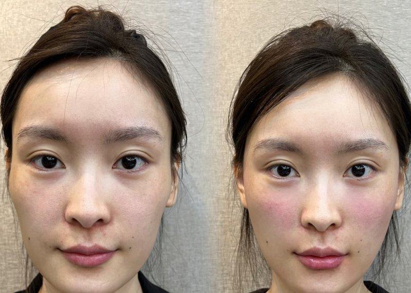 鸡西于秀群医疗美容诊所预约挂号方式：