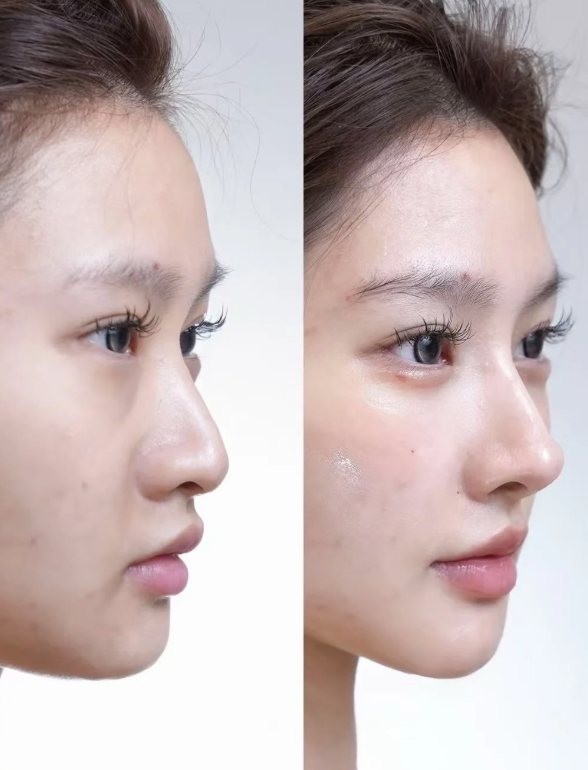 鸡西于秀群医疗美容诊所怎么样？