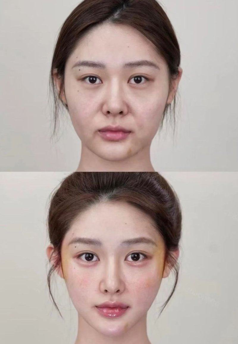 四、关于单眼皮双眼皮的常见容貌疑问