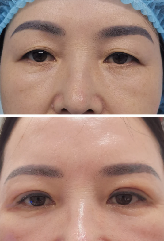 鸡西于秀群医疗美容诊所价格表：