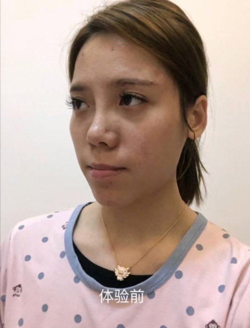 三、广东韩妃医疗美容医院：鼻综合手术的安心体验