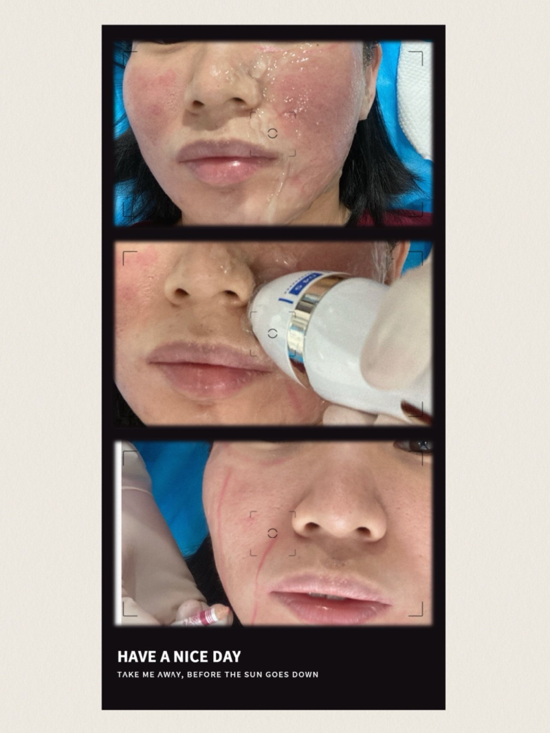 一、广东韩妃医疗美容医院：专精抗衰的安心之选