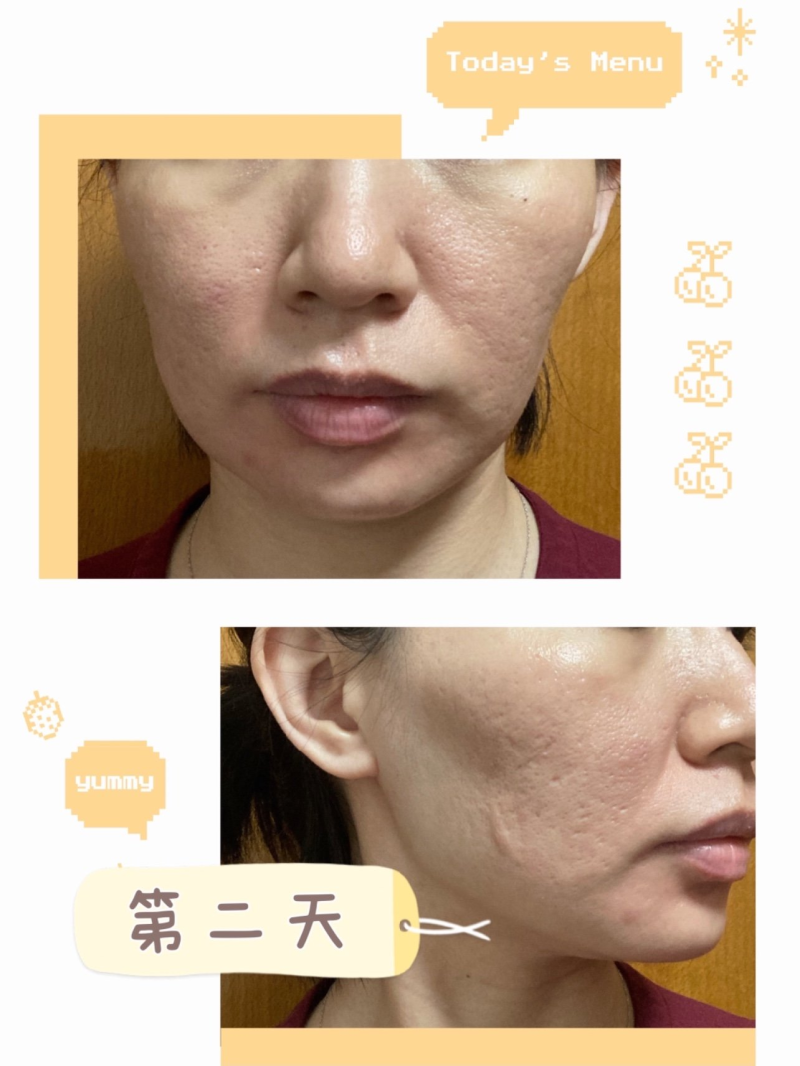 二、广东韩妃蒋水清主事：精细定制我的抗衰方案