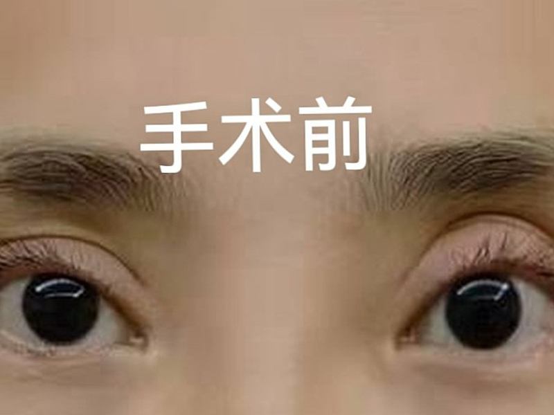 二、广东韩妃医疗美容医院的修复手术，是我重获新生的开始