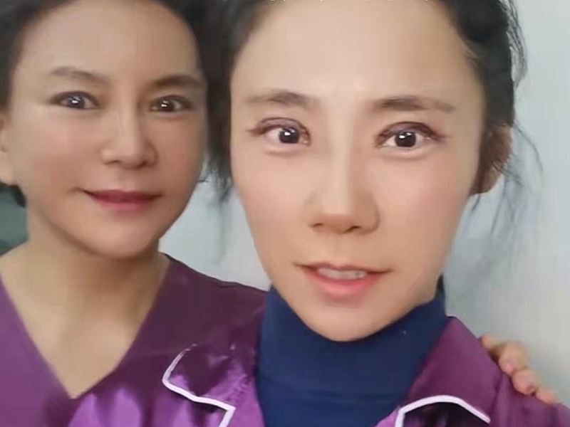 四、从广东韩妃医疗美容医院的修复经历，我想分享这些心里话