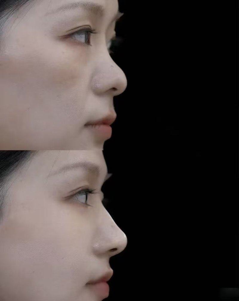 内蒙古呼和浩特紫洁一科整形医院口碑评价：