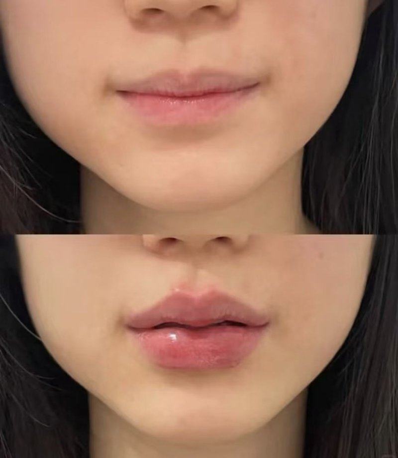 六、全新临床避险提示