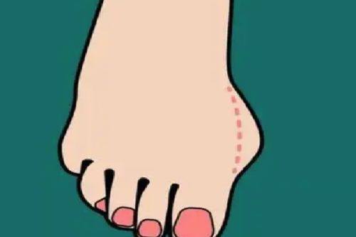 五、如何科学判断自己是否需要开眼角？