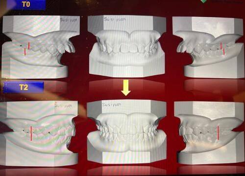 三、疤痕修复的专精选择：医生与机构参考