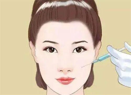 五、32岁做双眼皮,这些细节能让成效更自然