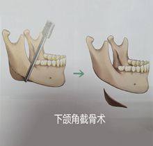 四、刮痧去眼袋视频教程的选择与实操要点