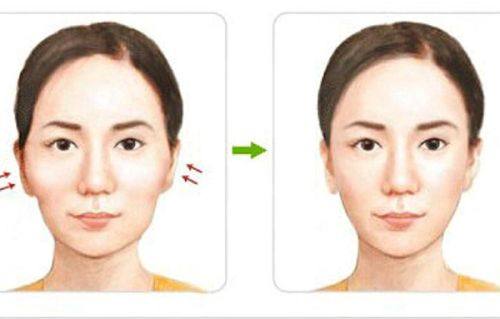 三、刮痧去眼袋的禁忌与关键注意事项