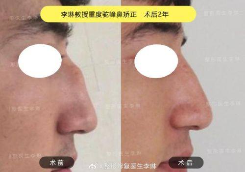 郑州柏丽芙医疗美容门诊部口碑评价：