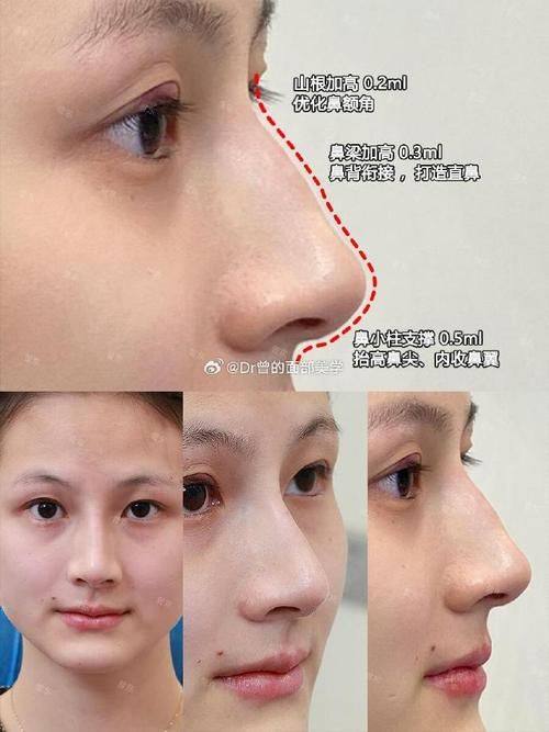 郑州柏丽芙医疗美容门诊部地址电话及营业时间：