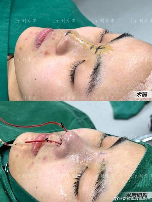 青岛瑧妍美医疗美容医院价格表：