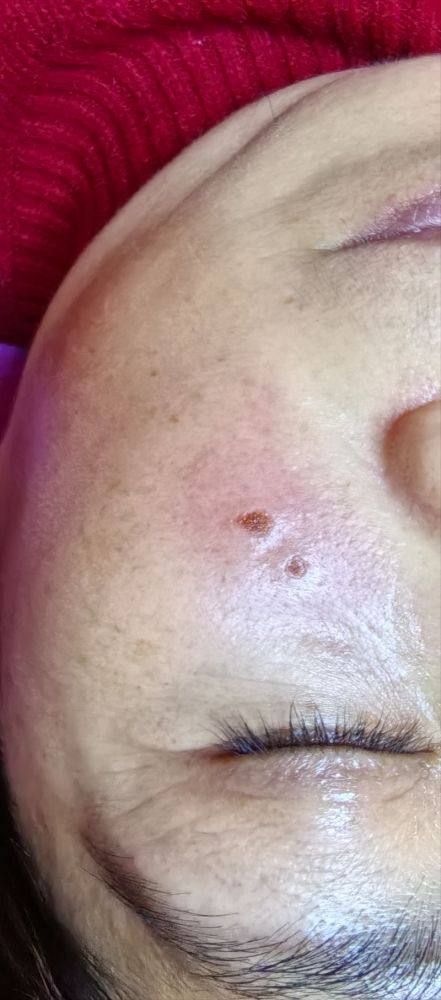 杭州悦可医疗美容诊所地址电话及营业时间：