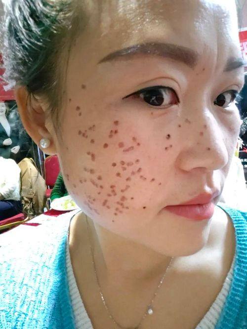 黑龙江青年医学会附属医院价格表：