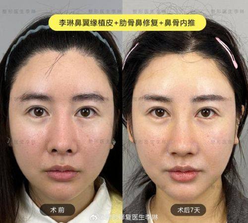 郑州柏丽芙医疗美容门诊部擅长项目：