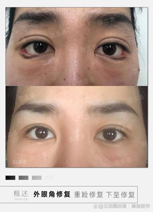 韩国奥拉克皮肤科整外科怎么样