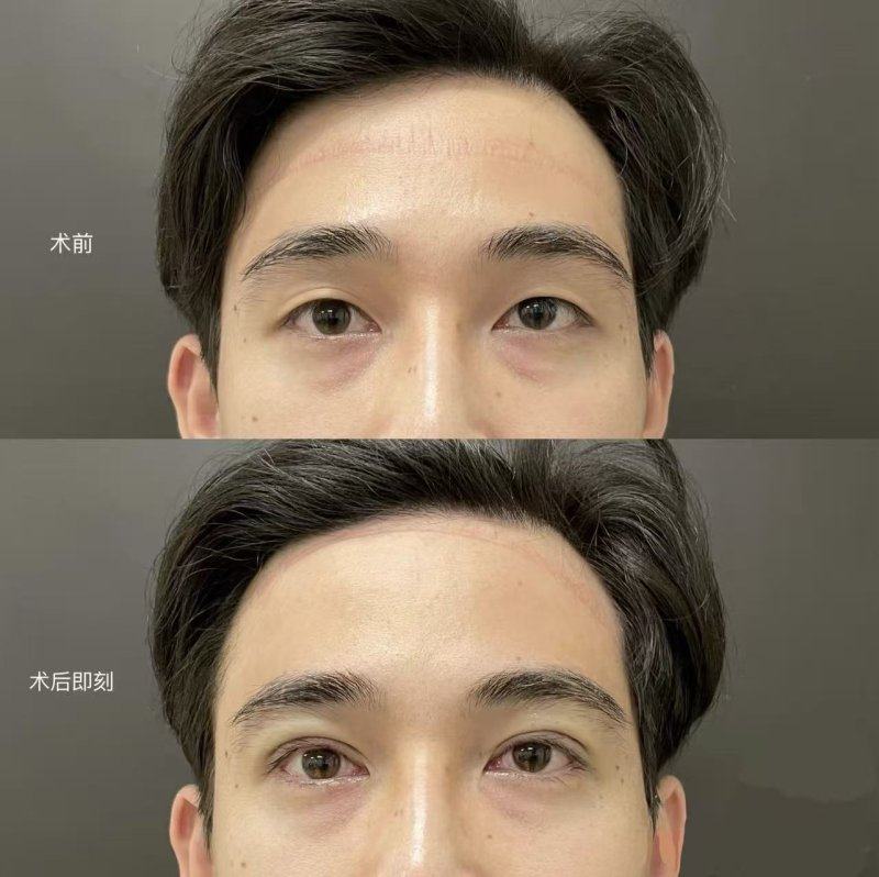 郑州柏丽芙医疗美容门诊部价格表：