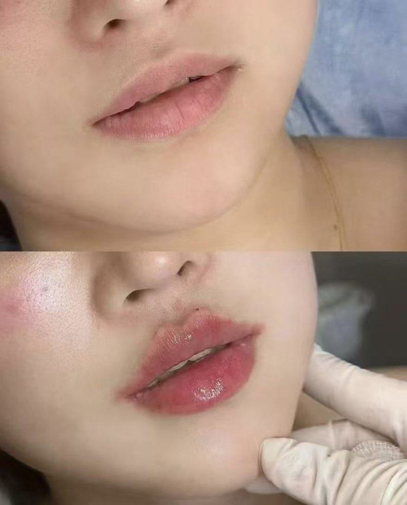 二、先辨明:红印是正常修复还是异常信号