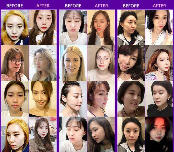 韩国GNG整形外科医院擅长项目