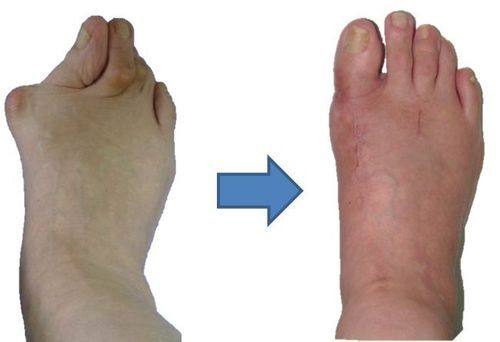 四、女生们该如何正确看待眼霜与眼袋的关系？