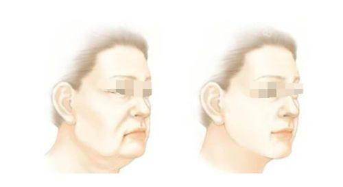四、2025年疤痕修复价格参考